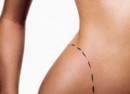 body-shape